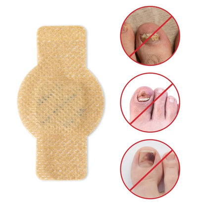 Nuvevia™ Anti-Fungal Nail Repair Patches