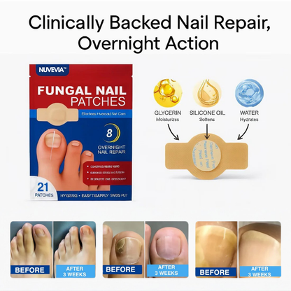 Nuvevia™ Anti-Fungal Nail Repair Patches